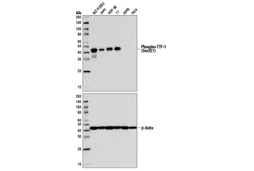 Phospho-TTF-1 (Ser327) Antibody - 100 ul