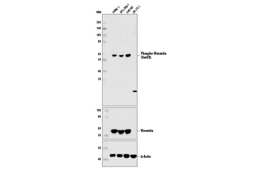 Phospho-Vimentin (Ser39) Antibody - 100 ul