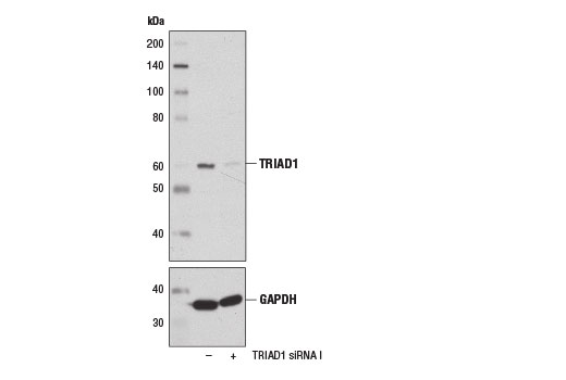 TRIAD1 Antibody - 100 ul