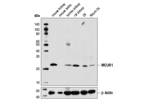 MCUR1 Antibody - 100 ul