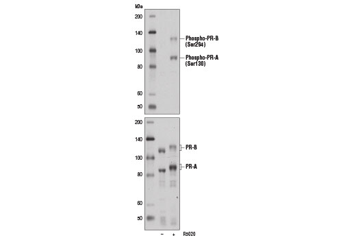 Phospho-Progesterone Receptor (Ser294) Antibody - 100 ul