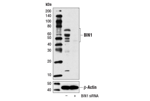 SignalSilence® BIN1 siRNA I - 300 ul