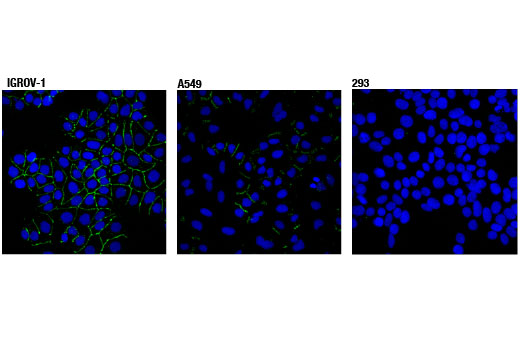 Epithelial-Mesenchymal Transition (EMT) IF Antibody Sampler Kit - 1 Kit