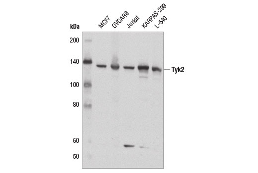 IFN (Type I/III) Signaling Pathway Antibody Sampler Kit - 1 Kit