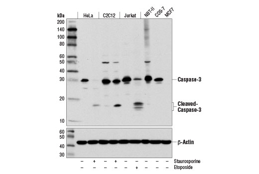 Apoptosis Antibody Sampler Kit (Mouse Preferred) - 1 Kit