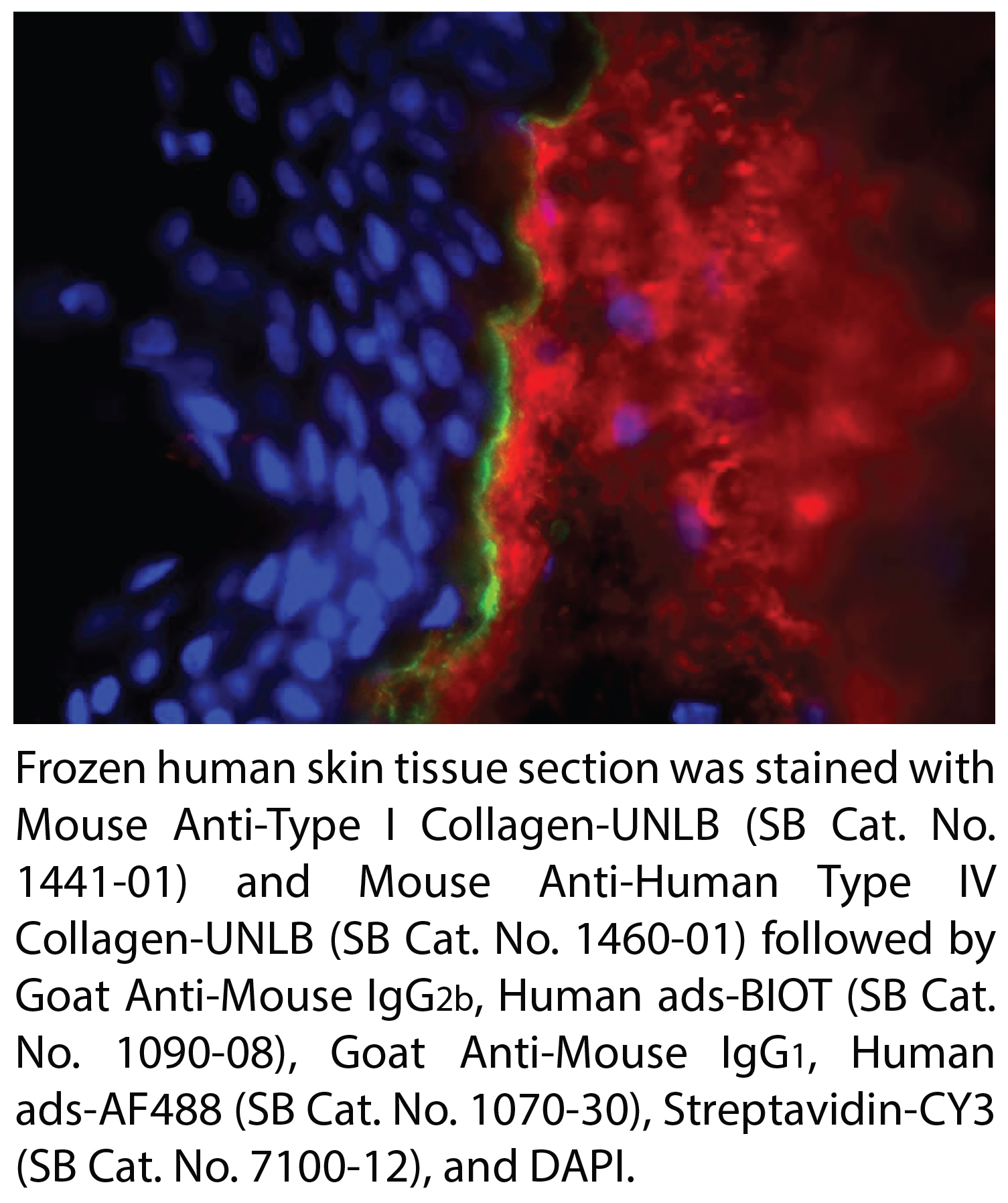 Mouse Anti-Human Type I Collagen-UNLB - 0.1 mg