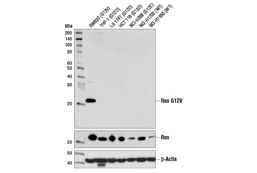 Mutant Ras Antibody Sampler Kit - 1 Kit