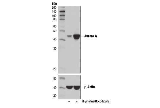 Aurora Antibody Sampler Kit - 1 Kit