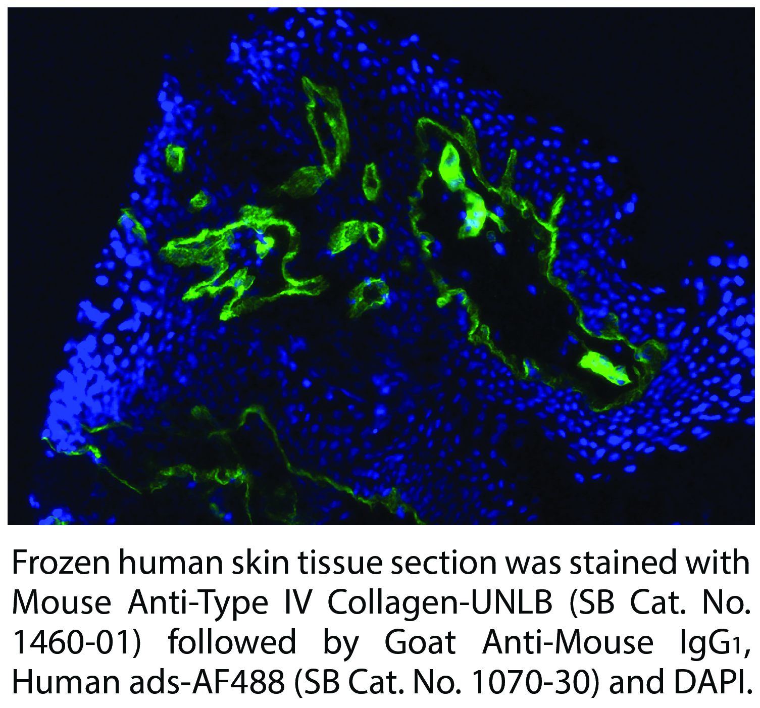 Mouse Anti-Human Type IV Collagen-UNLB - 0.1 mg