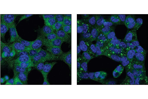 Autophagosome Marker Antibody Sampler Kit - 1 Kit