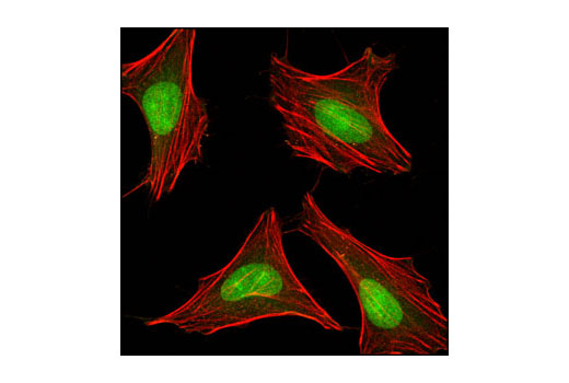 PP2A Antibody Sampler Kit - 1 Kit