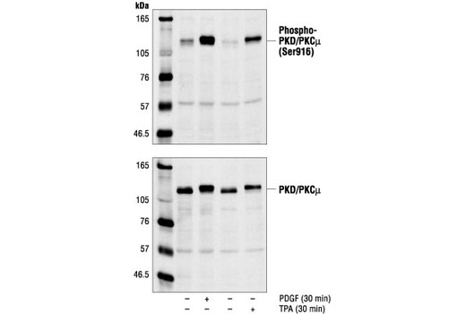 Phospho-PKC Antibody Sampler Kit - 1 Kit