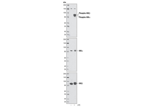 Phospho-IKKα/β (Ser176/180) Antibody Sampler Kit - 1 Kit