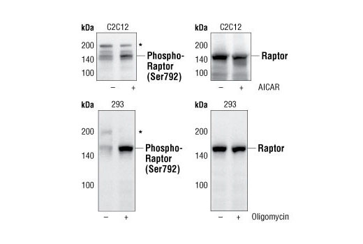 ULK1 Antibody Sampler Kit - 1 Kit