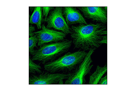 Cellular Localization IF Antibody Sampler Kit - 1 Kit