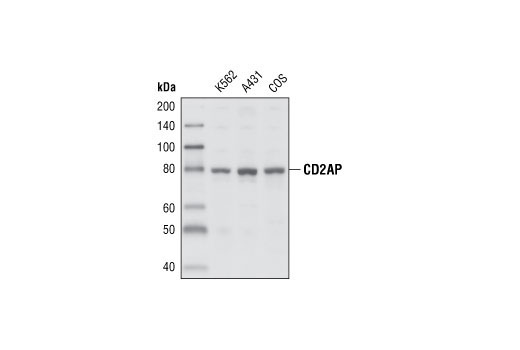 Tight Junction Antibody Sampler Kit - 1 Kit