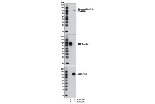 Phospho-HER2/ErbB2 Antibody Sampler Kit - 1 Kit