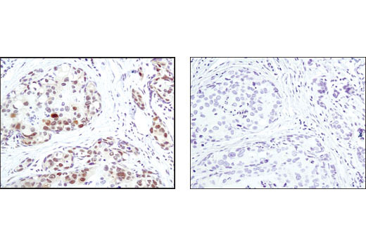 Phospho-(Ser) Kinase Substrate Antibody Sampler Kit - 1 Kit