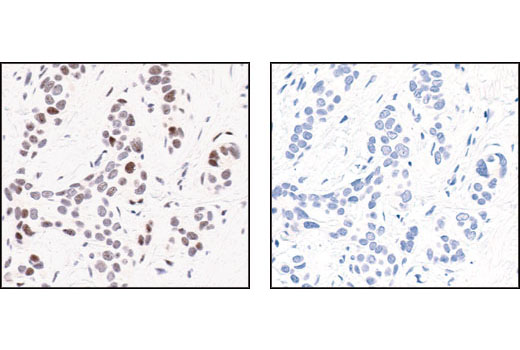 PhosphoPlus® c-Jun (Ser63) Antibody Duet - 1 Kit