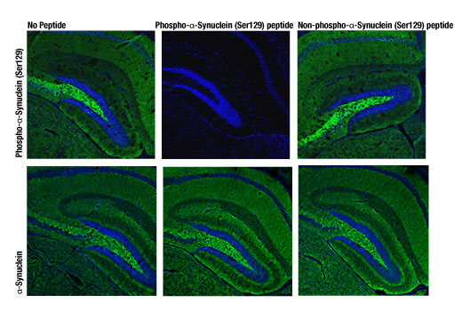 PhosphoPlus® α-Synuclein (Ser129) Antibody Duet - 1 Kit