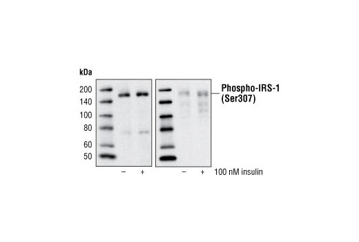 Insulin Receptor Substrate Antibody Sampler Kit - 1 Kit