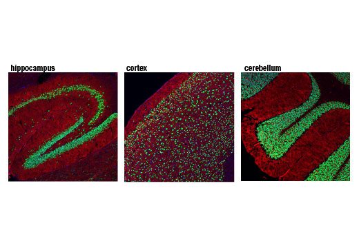 Mature Neuron Marker Antibody Sampler Kit - 1 Kit