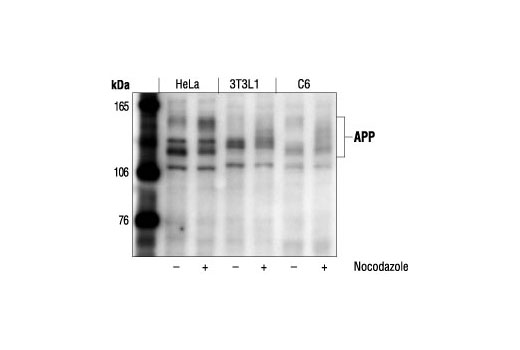 β-Amyloid Antibody Sampler Kit - 1 Kit