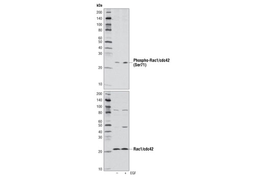 Actin Nucleation and Polymerization Antibody Sampler Kit - 1 Kit