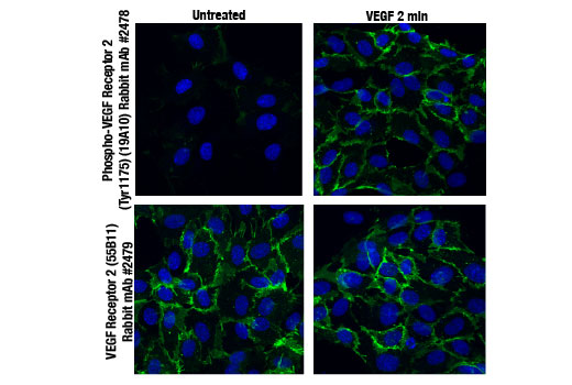 Angiogenesis Antibody Sampler Kit - 1 Kit