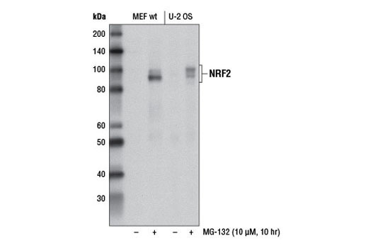 Sequestosome Signaling Antibody Sampler Kit - 1 Kit