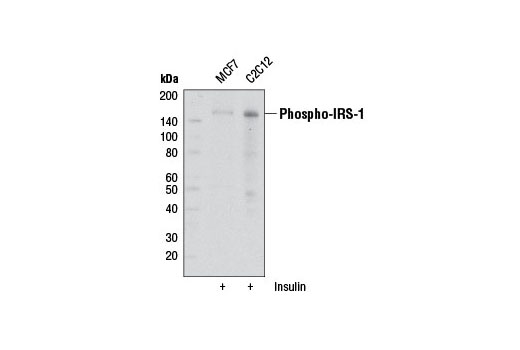 IRS-1 Inhibition Antibody Sampler Kit - 1 Kit