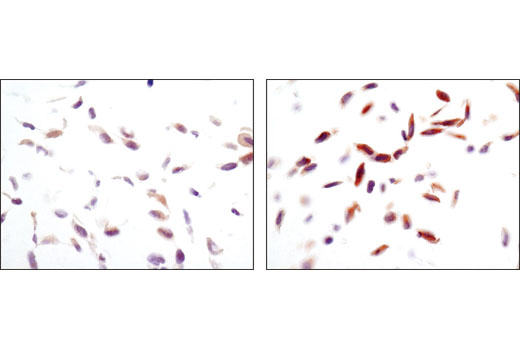 PhosphoPlus® AMPKα (Thr172) Antibody Duet - 1 Kit