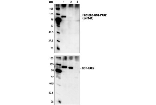 PAK 1/2/3 Antibody Sampler Kit - 1 Kit