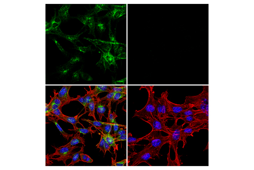 LRP1-mediated Endocytosis and Transmission of Tau Antibody Sampler Kit - 1 Kit