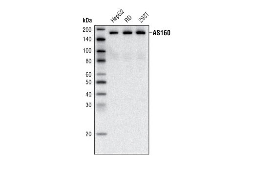 AS160 Signaling Antibody Sampler Kit - 1 Kit