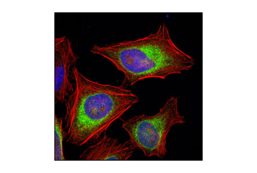 ER and Golgi-Associated Marker Proteins Antibody Sampler Kit - 1 Kit