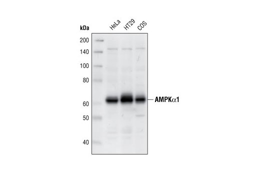 AMPK Subunit Antibody Sampler Kit - 1 Kit