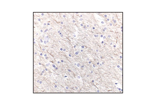 Neurofilament Antibody Sampler Kit - 1 Kit