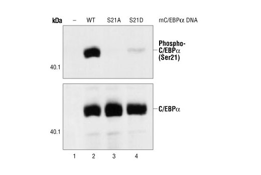 C/EBP Antibody Sampler Kit - 1 Kit