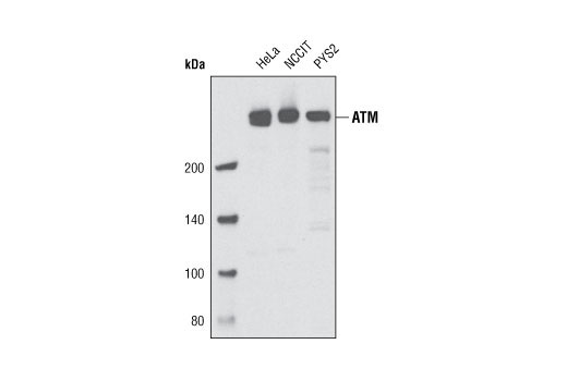 PhosphoPlus® ATM (Ser1981) Antibody Duet - 1 Kit