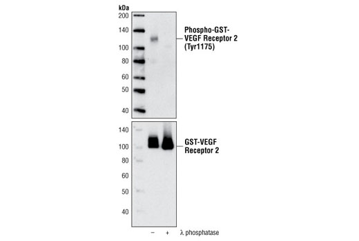 VEGF Receptor 2 Control Proteins - 150 ul