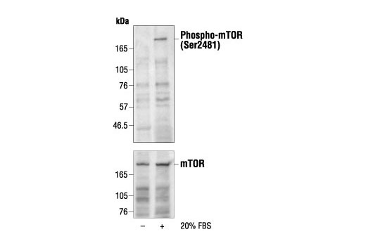 mTOR Pathway Antibody Sampler Kit - 1 Kit