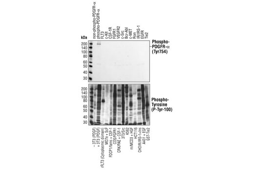 PDGF Receptor α Antibody Sampler Kit - 1 Kit