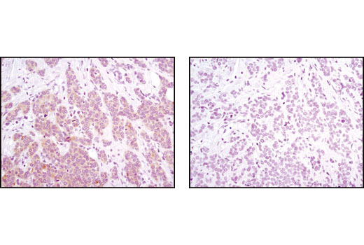 PhosphoPlus® PRAS40 (Thr246) Antibody Duet - 1 Kit