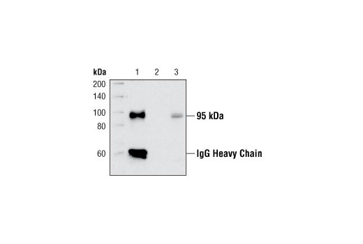 Insulin/IGF-1 Signaling Pathway Antibody Sampler Kit - 1 Kit