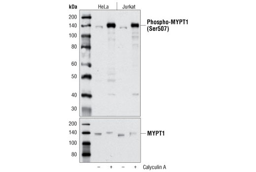 MYPT1 Antibody Sampler Kit - 1 Kit