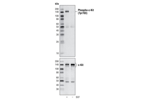 c-Kit Antibody Sampler Kit - 1 Kit