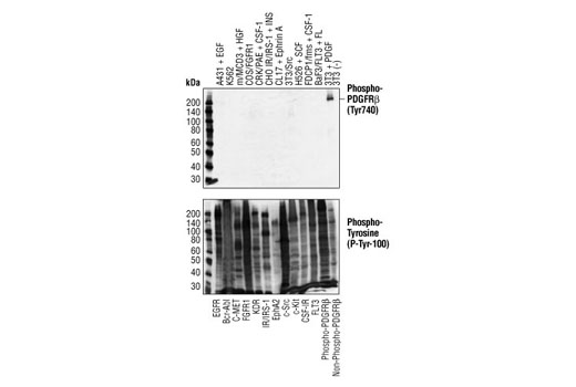 PDGF Receptor β Antibody Sampler Kit - 1 Kit