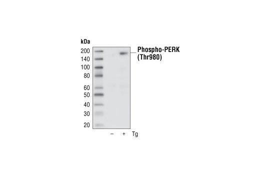 PhosphoPlus® PERK (Thr980) Antibody Duet - 1 Kit