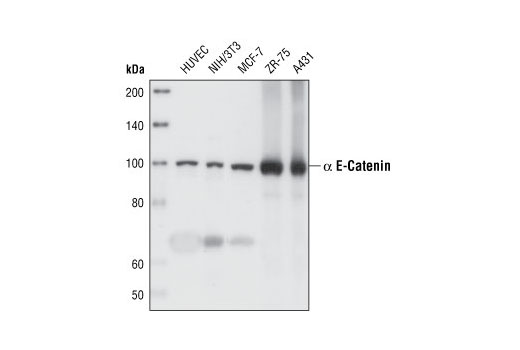 Cadherin-Catenin Antibody Sampler Kit - 1 Kit